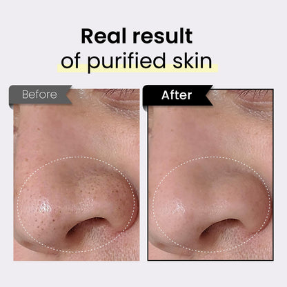 Coxir TXA Black Rice Pore Mask – 3-in-1 Wash-Off Serum for Pore Purification, Hydration & Tone | Vegan K-Beauty 50ml
