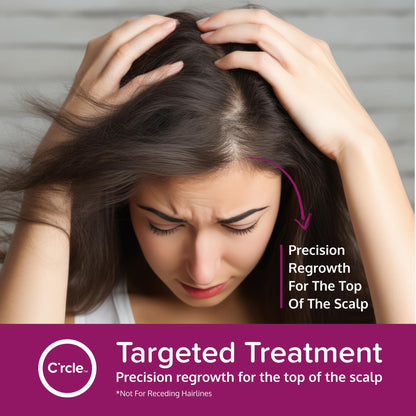 C'rcle Minoxidil 5% Foam for Women – Hair Regrowth & Thinning Hair Solution (4-Month Supply)