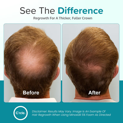 C'rcle Minoxidil for Men Foam 5% - Unscented, 6-Month Supply