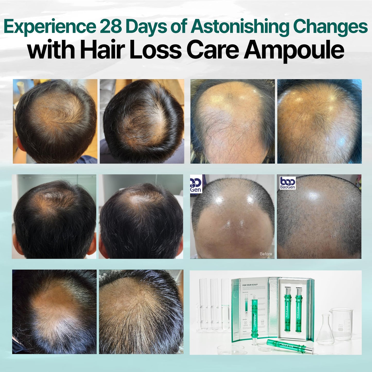 BAO_H.LAB Hair Loss Care Ampoule – CrediThink, 2 Ampoules, Non-Greasy