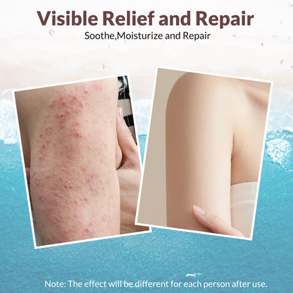 Crogooe Natural Soothing Eczema Cream – Sea Moss, Aloe Vera & Oats (4 oz)