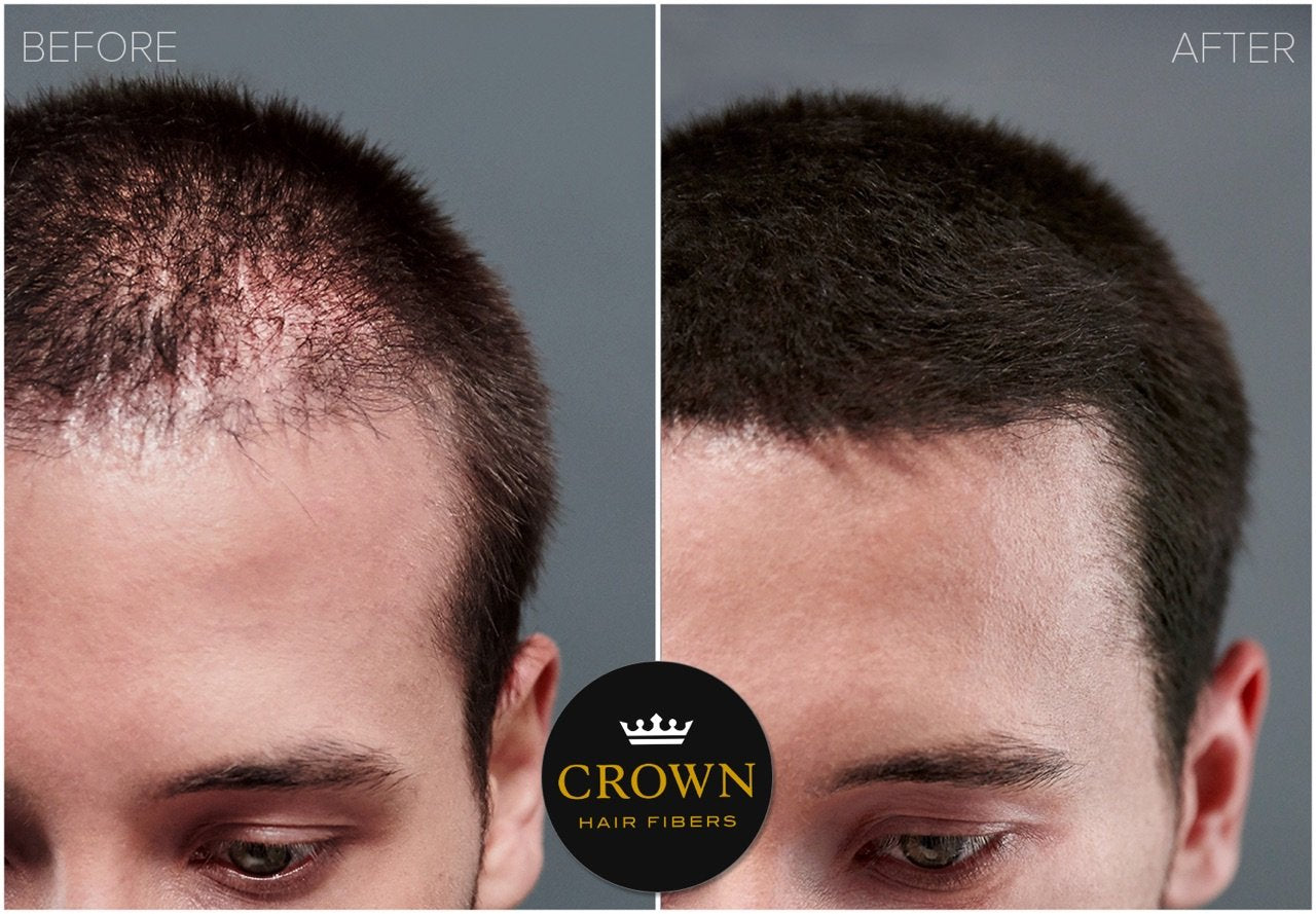 CROWN Hair Building Fibers (28g) – Instant Thick Look, 13 Shades | CROWN TWENTY1