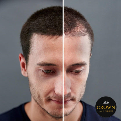 CROWN Hair Building Fibers (28g) – Instant Thick Look, 13 Shades | CROWN TWENTY1