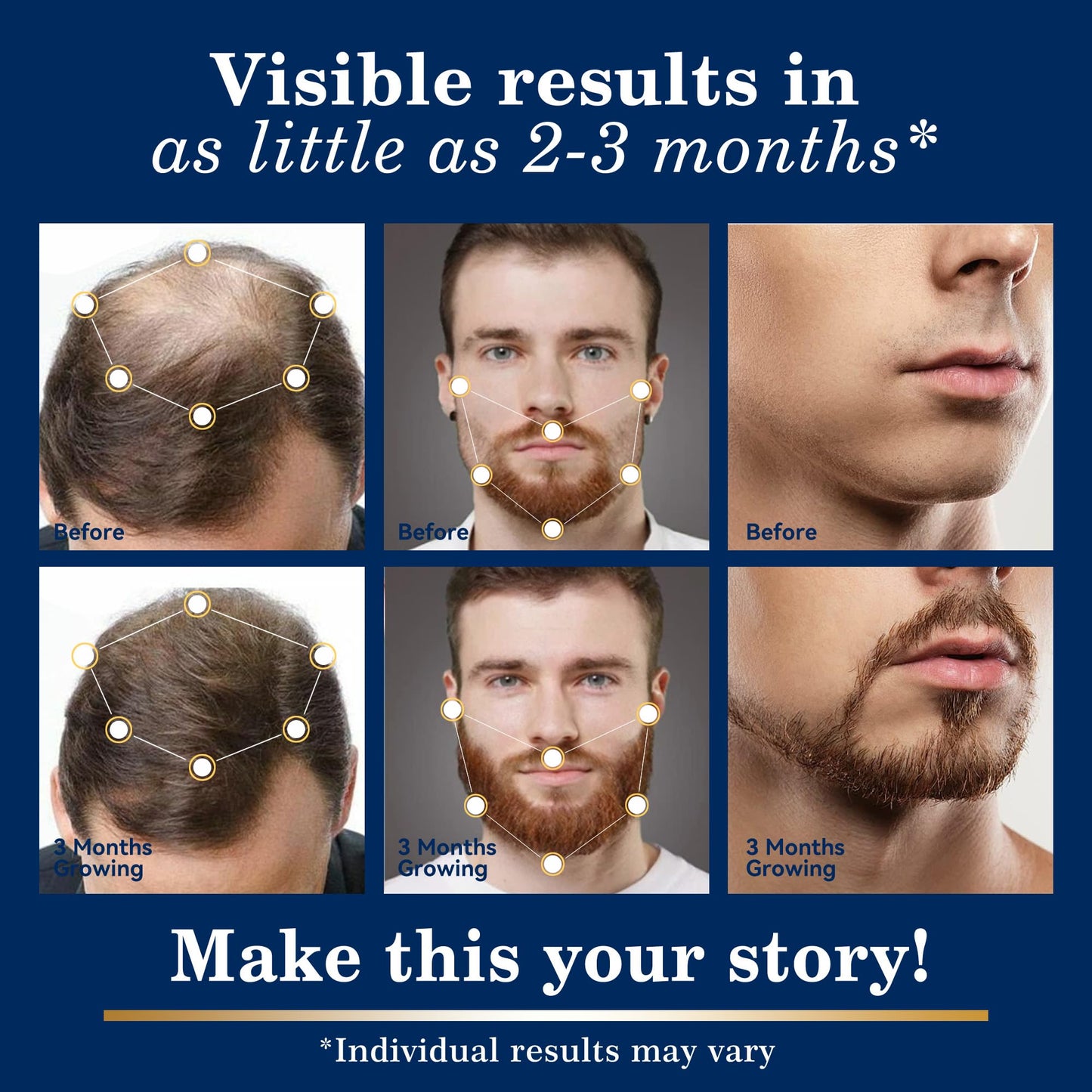 DAAZZS 5% Minoxidil Hair Growth Kit for Men & Women – Beard & Scalp Therapy, Biotin Included (2-Pack)