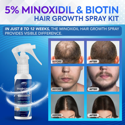 DABIDA 5% Minoxidil Spray for Men & Women – Hair Growth & Beard Growth, 3x60ml