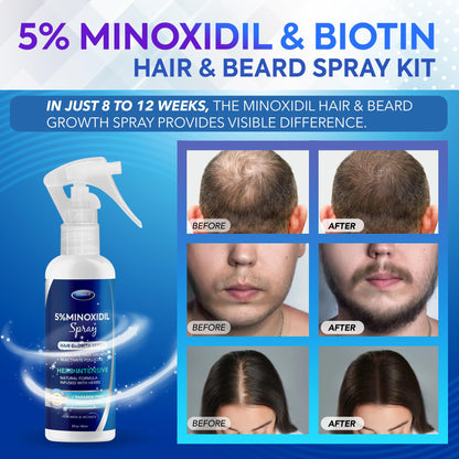 DABIDA 5% Minoxidil Hair Regrowth Spray – For Women & Men, 60ml