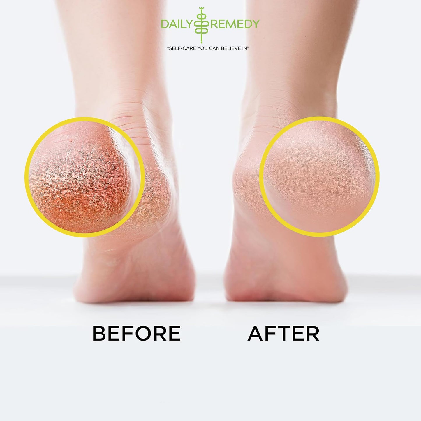 Daily Remedy Citrus Detox Foot Soak with Epsom Salt | Foot Care Pedicure | Made in USA