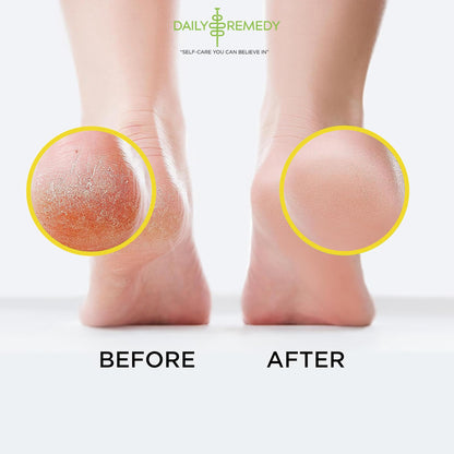 Daily Remedy Citrus Detox Foot Soak with Epsom Salt | Foot Care Pedicure | Made in USA