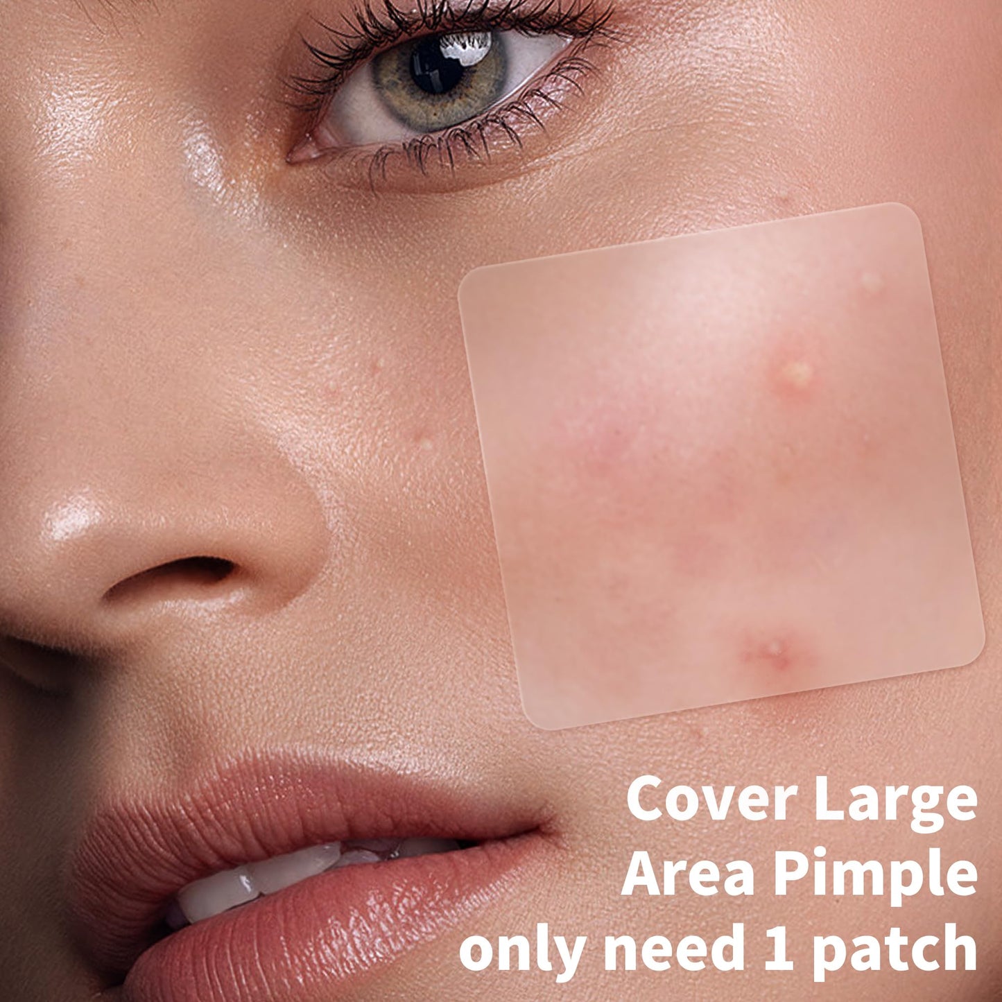 Daolyo Large Pimple Patches – 7 Sizes, 210 Patches for Face & Body