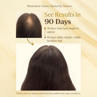 D'Cherlane Hair Growth Oil – Scalp Treatment with Rosemary, Argan, Coconut & Castor Oil | Lightweight, Non-Greasy Formula
