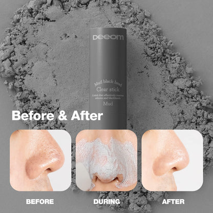 DEEOM Blackhead Remover Stick | Deep Pore Cleansing Charcoal for Blackheads & Whiteheads | 14g
