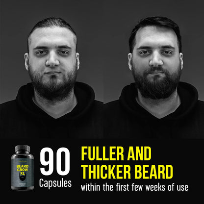 Delta Genesis Beard Grow XL | Vegan Beard Growth Supplement for Fuller, Thicker Beards