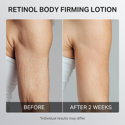 Depology Ultra-Size Firming Retinol Body Lotion for Crepey Skin & KP | 0.05% Retinol, AHA, Collagen, 10.14 fl oz
