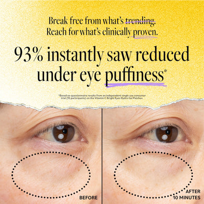 Derma E Vitamin C Bright Eyes Hydro Gel Under Eye Patches – 10 Ct (5 Pairs) Allantoin, Caffeine & Vitamin B3