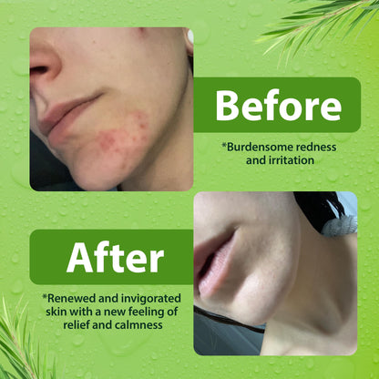 Derma-Nu Antibacterial Body Wash | Tea Tree, Jock Itch & Athlete's Foot Care, 8 oz