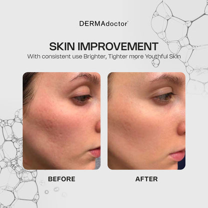 DERMAdoctor Vitamin C Serum 20% with Vitamin E & Ferulic Acid — Brightening, Hydrating Anti-Aging Serum | 1 oz