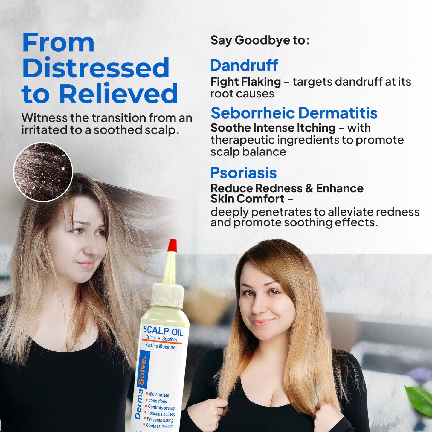 Dermasolve Psoriasis & Dandruff Oil – Dermatologist-Approved Scalp Relief