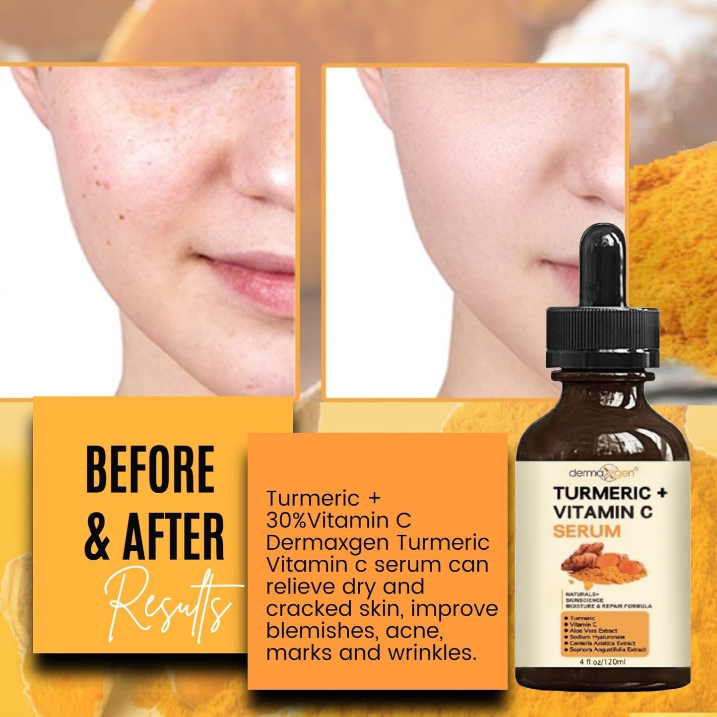 DERMAXGEN Turmeric Serum + Vitamin C — Glow-Boosting Organic Moisturizer (4 oz)