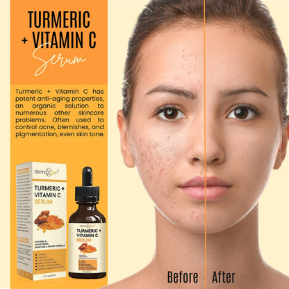 DERMAXGEN Turmeric Serum + Vitamin C – Glow-Boosting Organic Moisturizer (2 fl oz)