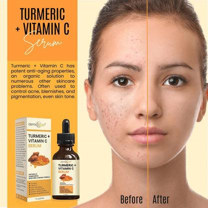 DERMAXGEN Turmeric + Vitamin C Serum – Pure Organic Anti-Aging for All Skin Types