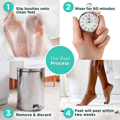 DERMORA Foot Peel Mask – Exfoliating Foot Masks for Dry, Cracked Feet & Callus Removal | Pack of 2 | Regular Size