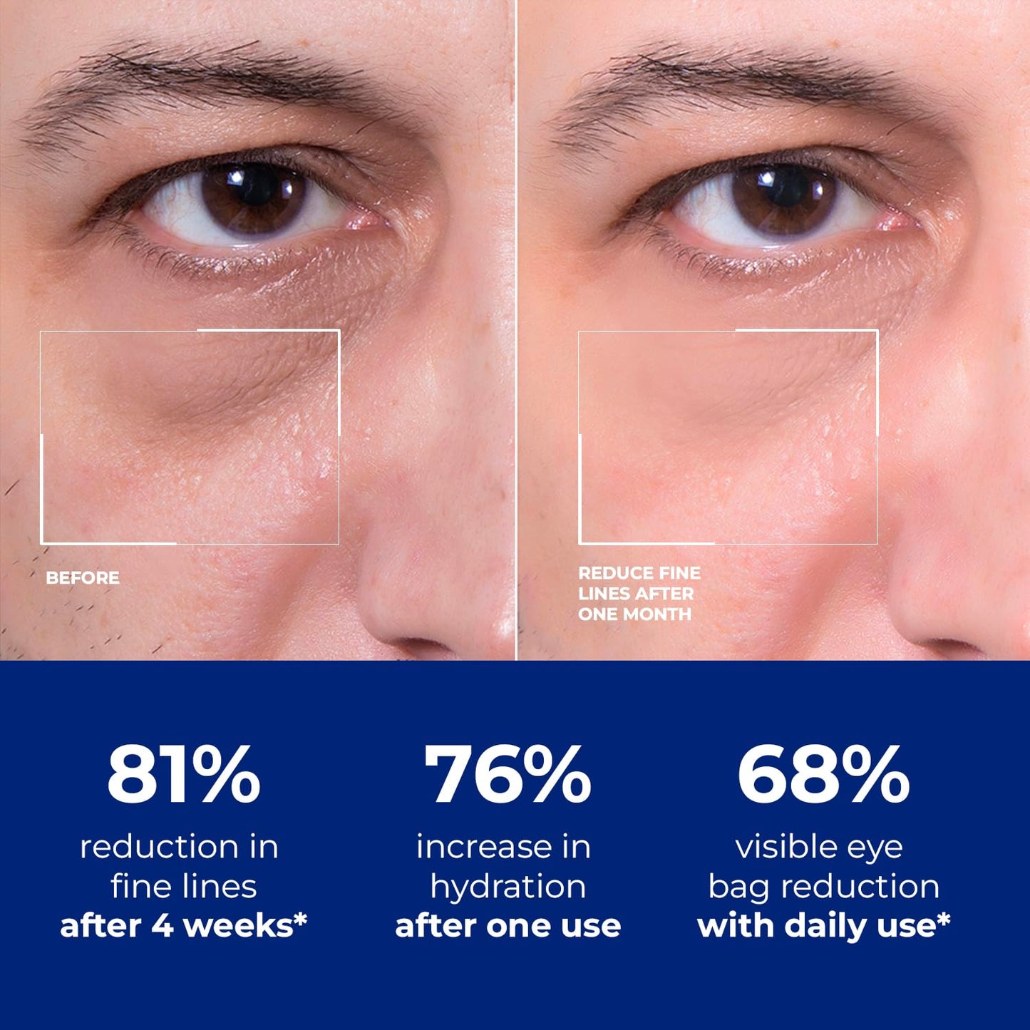 DIPSEVEN Men's Eye Cream - Under Eye Treatment for Bags, Wrinkles & Dark Circles - Peptides + Hyaluronic Acid