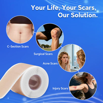 Discoliner Silicone Scar Sheets – Reusable Scar Tape (3M) for Surgical, C-Section, Acne & Burn Scars