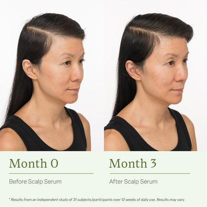 Divi Scalp Serum for Thinning Hair, 2-Pack, 30ml – Clinically Tested with Caffeine & Rosemary