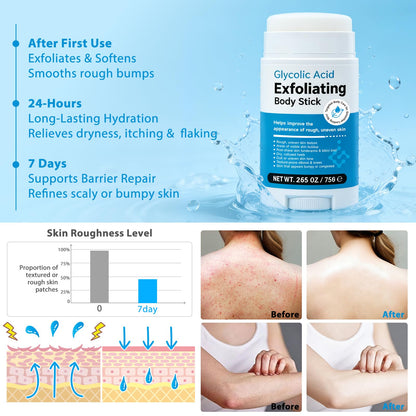 DNQYWODQ 7% Glycolic Acid Exfoliating Body Stick – Smooth Elbows, Knees & Bikini Line