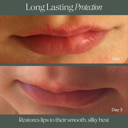 Doctor Rogers Lip Balm | Hydrating & Softening Lip Moisturizer for Very Dry Lips (0.15 oz)