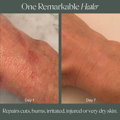 Doctor Rogers Restore Healing Balm — Multi-Purpose Ointment for Dry Skin, Eczema & Sensitive Skin (4 oz)