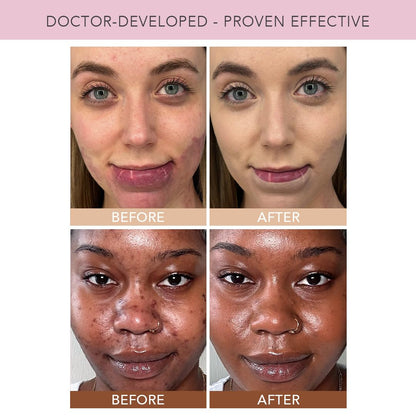 Doll 10 NO TCE Liquid Filter – Deep/Rich CC Cream & Skin Tint, Lightweight Foundation, Pore Blur, Vegan Clean Makeup, 30 Day Supply