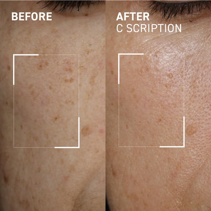 Dr. Brandt Bright This Way C Scription Vitamin C Serum – Fade Dark Spots & Illuminate Skin Tone (2 x 1 fl oz)