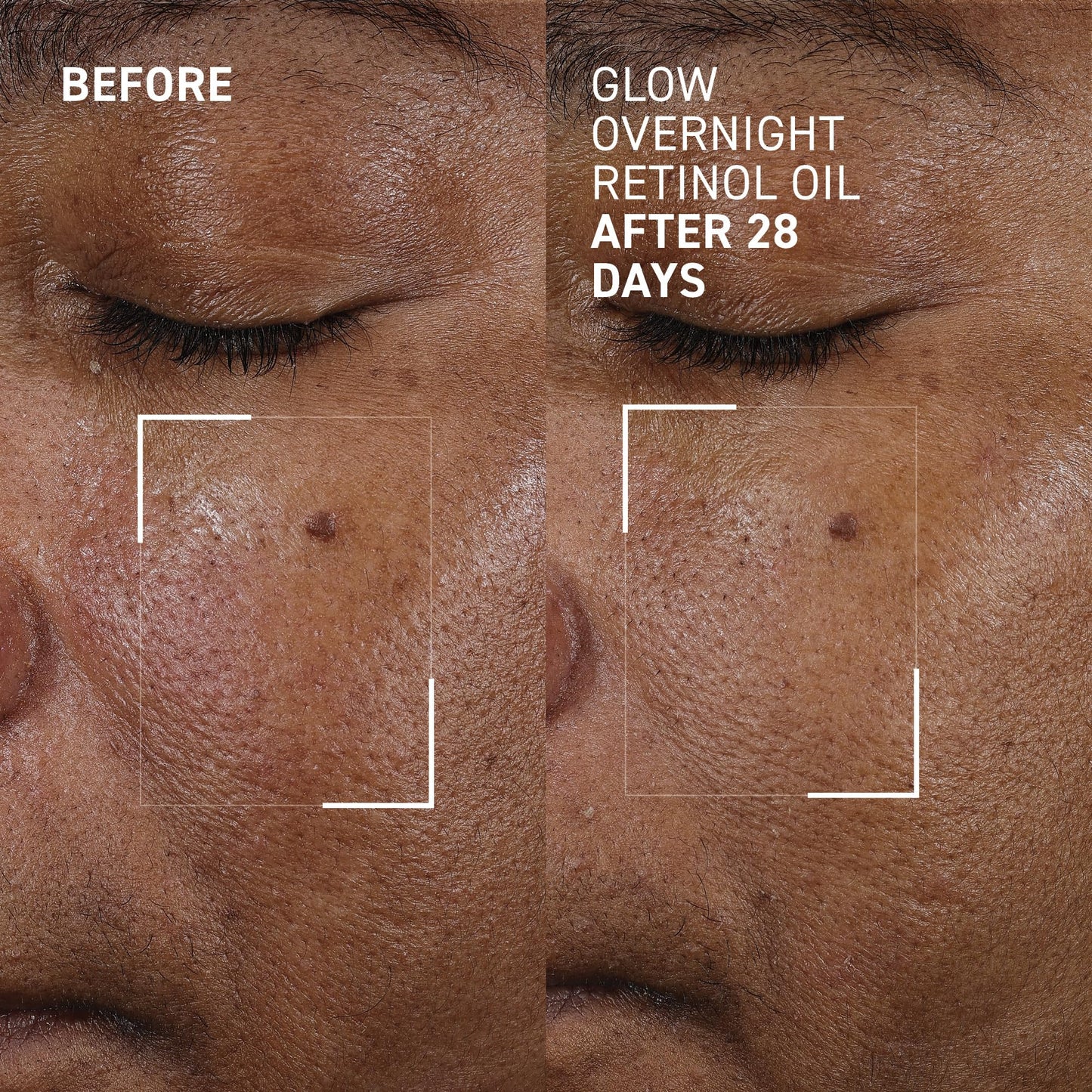 Dr. Brandt Bright This Way Glow Overnight Retinol Oil – 2 x 1 fl oz, 2% Retinol for Texture & Radiance