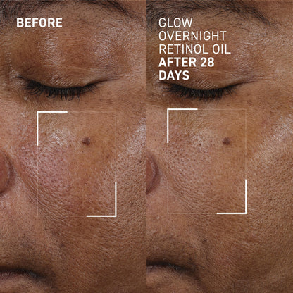Dr. Brandt Bright This Way Glow Overnight Retinol Oil – 2 x 1 fl oz, 2% Retinol for Texture & Radiance