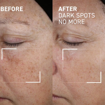 Dr. Brandt Bright This Way Dark Spots No More – 0.5 Fl Oz Pack of 2 | Target Hyperpigmentation