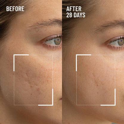 Dr. Brandt Microdermabrasion Renewing Face Exfoliator – 2-Pack, Smooth Texture
