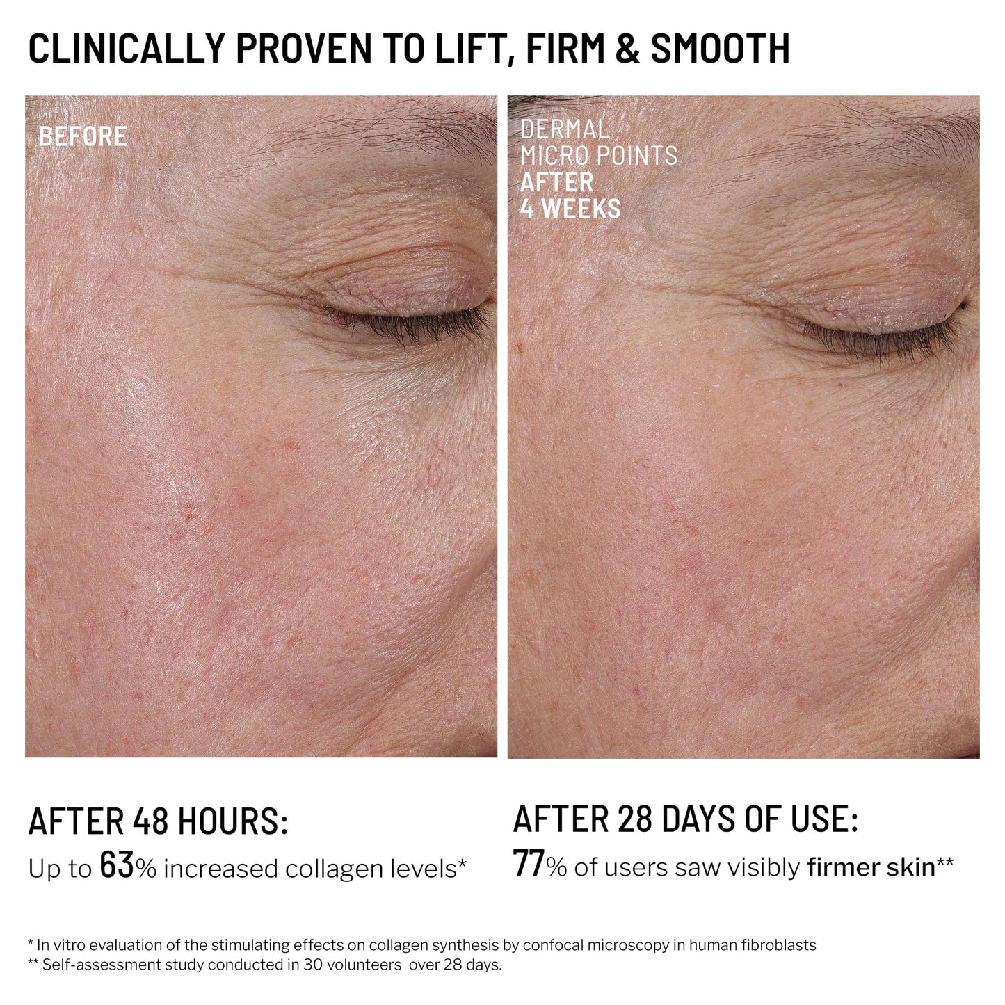 Dr. Brandt Needles No More Dermal Micro Points – Intensive Skin-Lifting Gel for Texture & Fine Lines | 1.0 oz