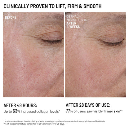 Dr. Brandt Needles No More Dermal Micro Points – Intensive Skin-Lifting Gel for Texture & Fine Lines | 1.0 oz