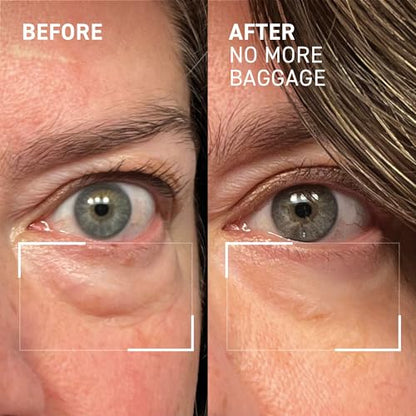 Dr. Brandt Needles No More Baggage – 0.23 oz Pack of 2 | Eye De-Puffing Gel for Bags, Puffiness & Dark Circles