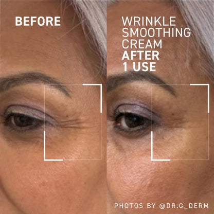 Dr. Brandt Needles No More Wrinkle Smoothing Cream – Smooths Lines & Firms Skin (0.5 oz, Pack of 2)