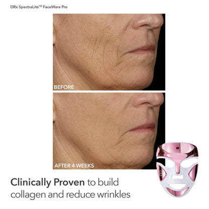 Dr Dennis Gross dpl FaceWare Pro Pink LED Mask Gift Set – Collagen, Brightening & Firming with Cleansing Oil, Dewy Deep Cream & 5 Universal Daily Peels | $592 Value