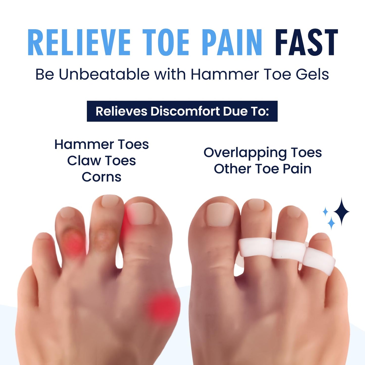 Dr. Frederick's Original Hammer Toe Corrector Gels – 2 Pairs for All-Day Toe Alignment