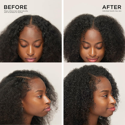Dr. Groot Hair Thickening Serum | Roll-On Scalp Treatment | Clinically Tested