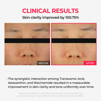 Dr.Melaxin TXA Astaxanthin Overnight Peel-Off Mask – Glow, Hydration & Texture