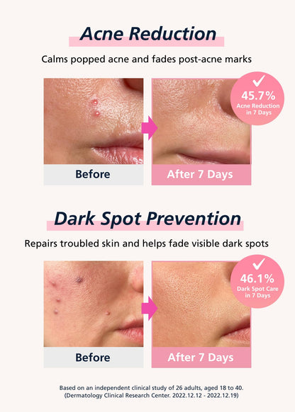 Easyderm Real Calming Patch – 6-Spot K-Beauty Patch with Niacinamide, Hyaluronic Acid & EGF | DWEasyDerm