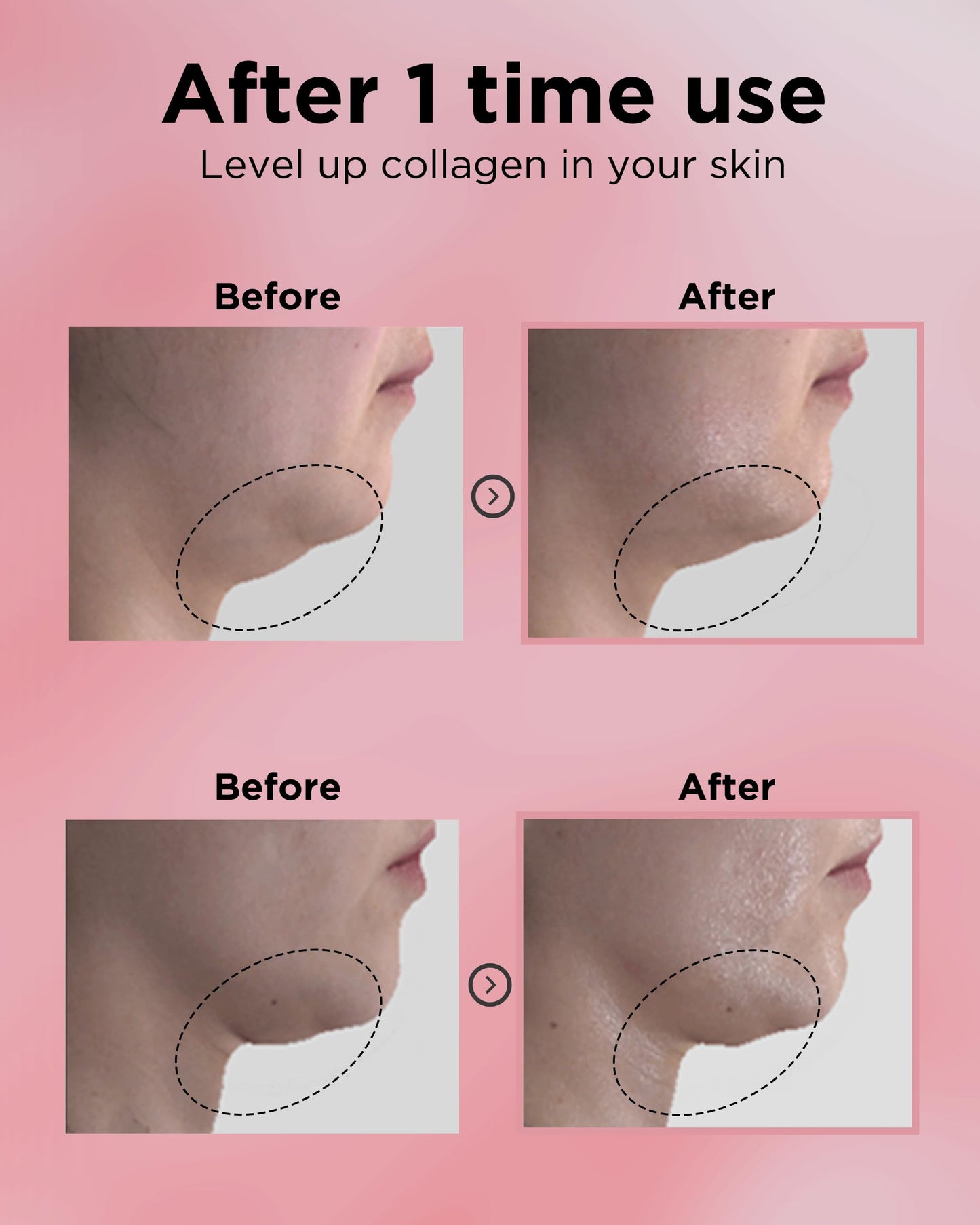 EASYDEW DW-EGF 55% Collagen Silkream Ampoule – Korean Serum for Firmness & Elasticity