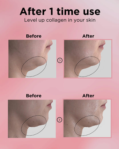EASYDEW DW-EGF 55% Collagen Silkream Ampoule – Korean Serum for Firmness & Elasticity