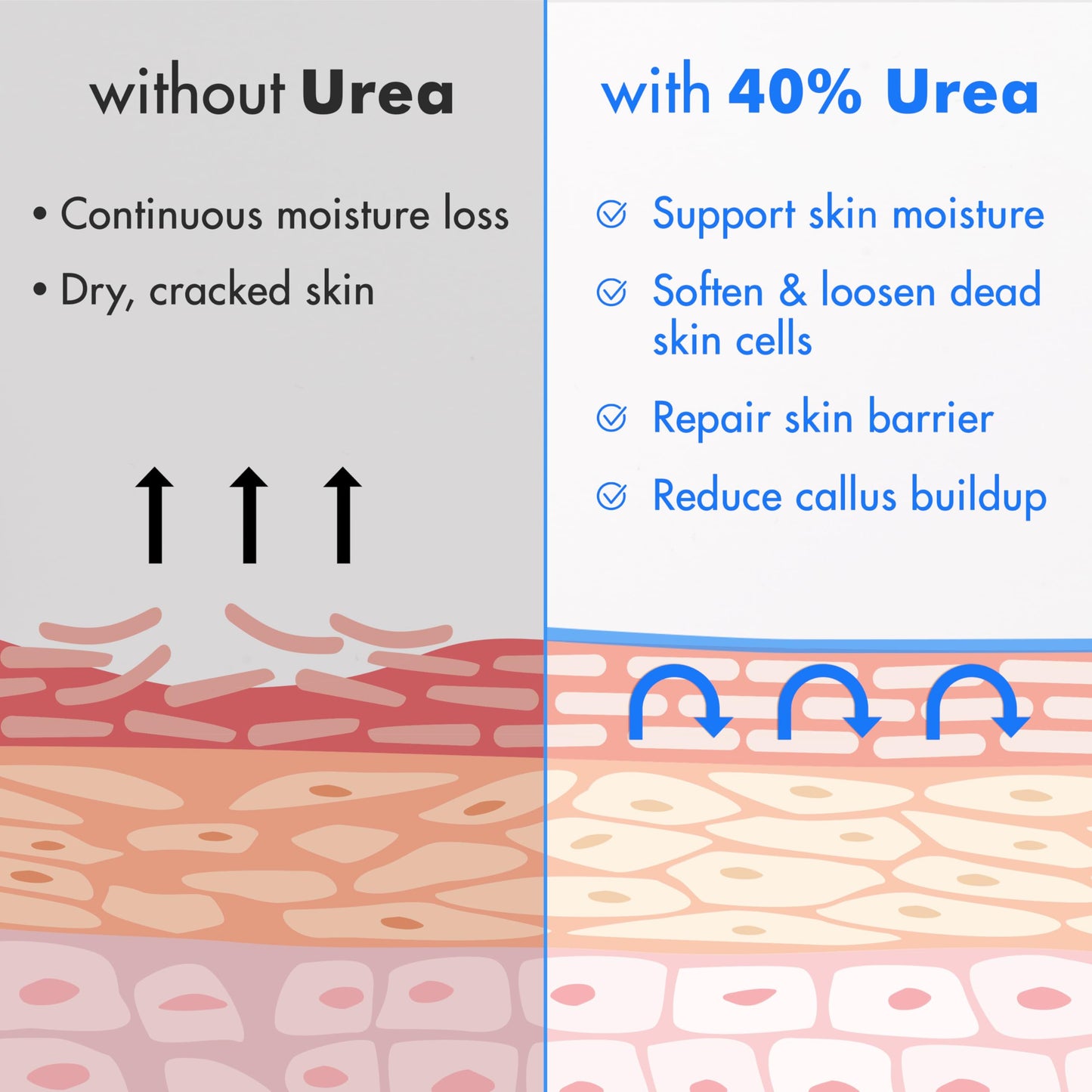 Ebanel Urea Cream 40% + 2% Salicylic Acid – Foot & Skin Keratolytic Care (2-Pack)