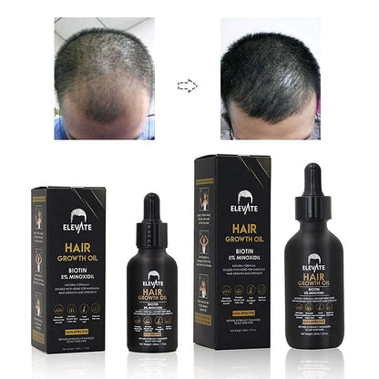 Elevate Hair Regrowth Treatment 5% Minoxidil with Biotin Serum – Thicker, Fuller Hair for Men & Women